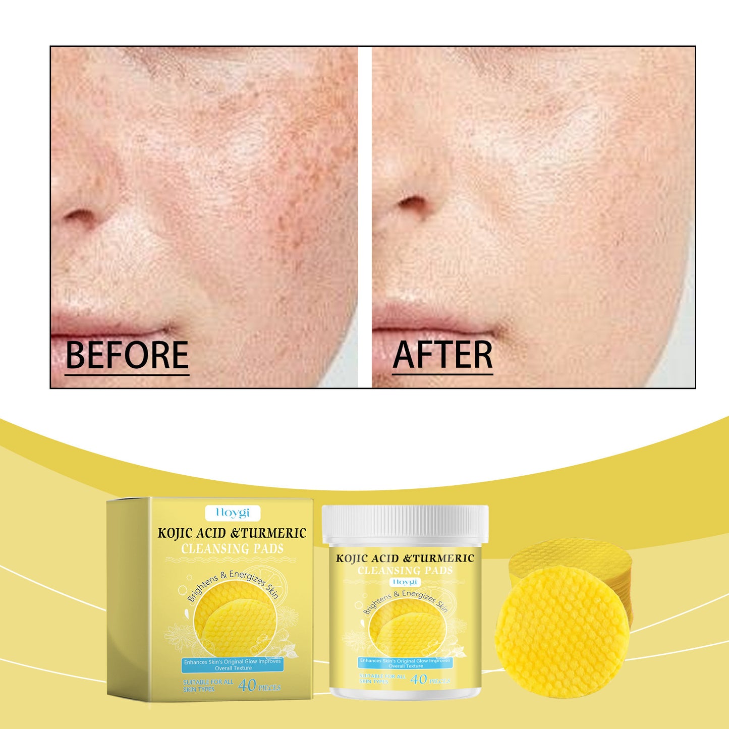 Turmeric Kojic Acid Cleansing Face Daily Cleaning